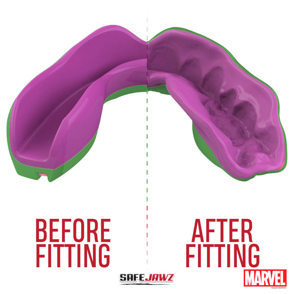 SAFEJAWZ MONDBESCHERMER MARVEL DE HULK